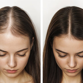 Gummies for Hair Skin and Nail Duhrelax